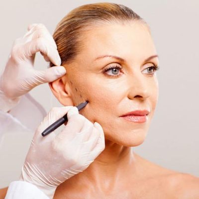 lifting-facial-porto-alegre lifting-facial-porto-alegre